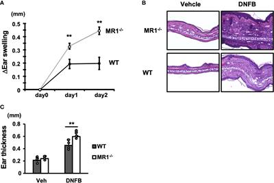 MR1 deficiency enhances IL-17-mediated allergic contact dermatitis